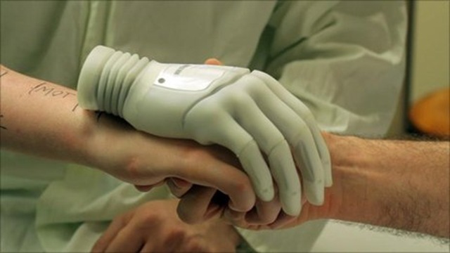 Les premiers humains à choisir de se soustraire d’un membre naturel pour une prothèse bionique. (Vidéo)