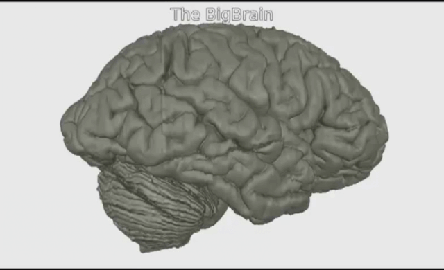 L’intégralité d’un cerveau humain cartographié en 3 dimensions