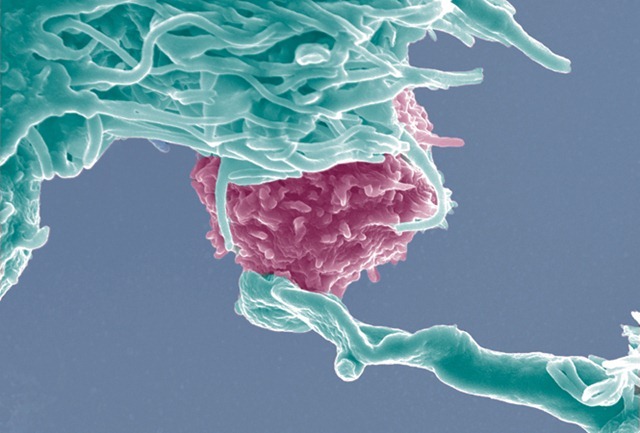 Des cellules de notre système immunitaire se rappellent de microbes qu’elles n’ont jamais rencontrés auparavant