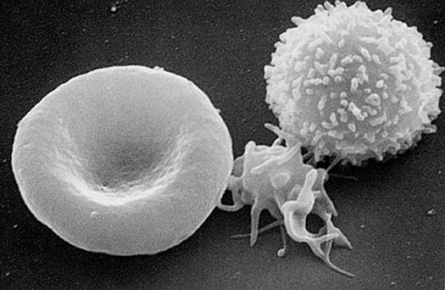 La séquence vidéo d’une cellule T à l’attaque d’une cellule cancéreuse.