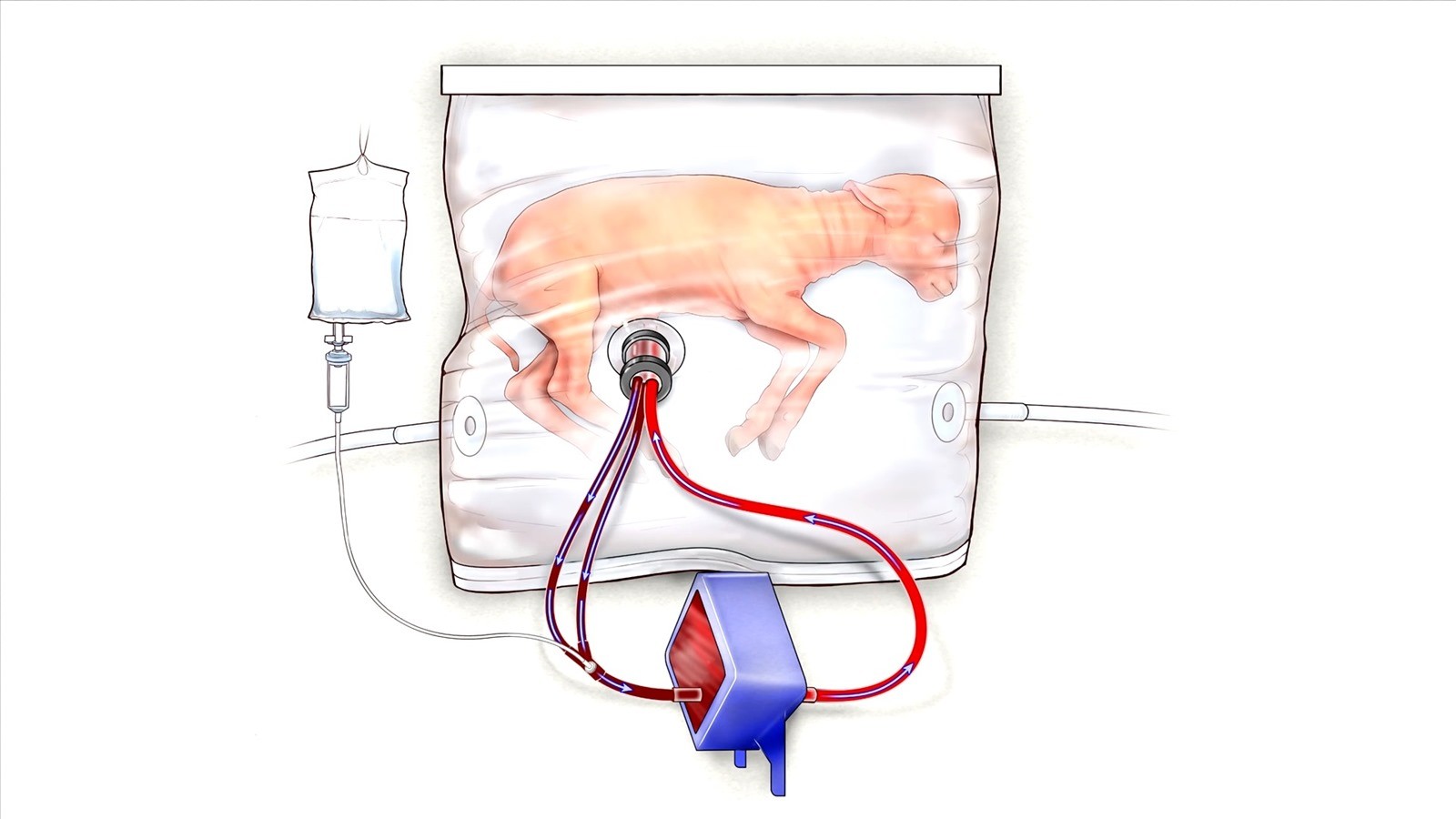 Des agneaux très prématurés ont terminé leur développement dans un placenta artificiel