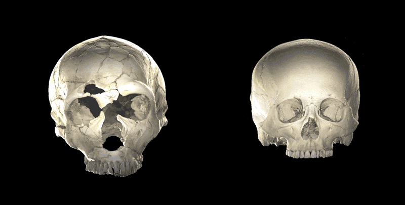 Comment vos gènes de néandertaliens pourraient influencer la forme de votre cerveau