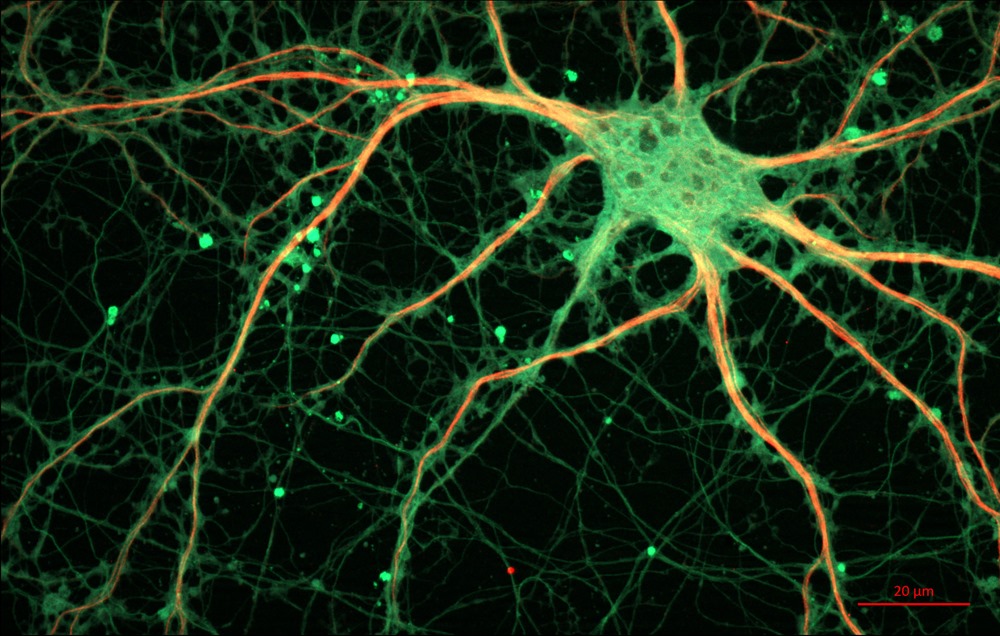 Pourra-t-on finalement savoir si l’humain adulte produit encore des neurones ?