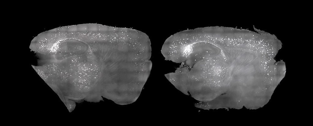 Un curieux traitement par lumière stroboscopique et par le son inverse les symptômes de la maladie d’Alzheimer chez la souris