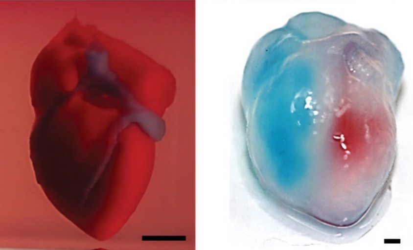 Le tout premier cœur complet imprimé en 3D en utilisant des cellules humaines