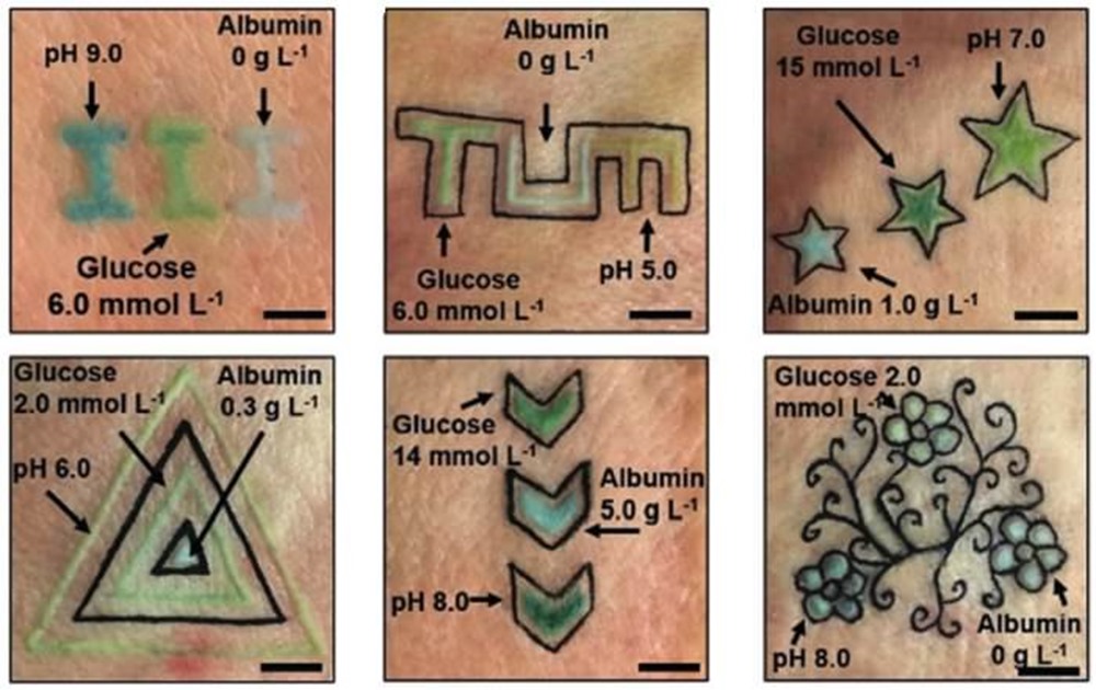 Des tatouages dont les couleurs changent selon les variations du taux de glucose, d’albumine ou du pH