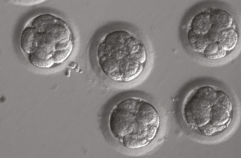 Étude rétractée : la modification génétique des premiers bébés CRISPR ne les condamnera pas à une mort prématurée