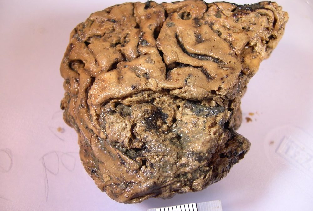 Les secrets du cerveau préservé d’un homme décapité il y a 2 600 ans