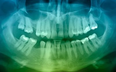 Cernes dentaires : nos dents présentent les plus importants événements biologiques de notre vie