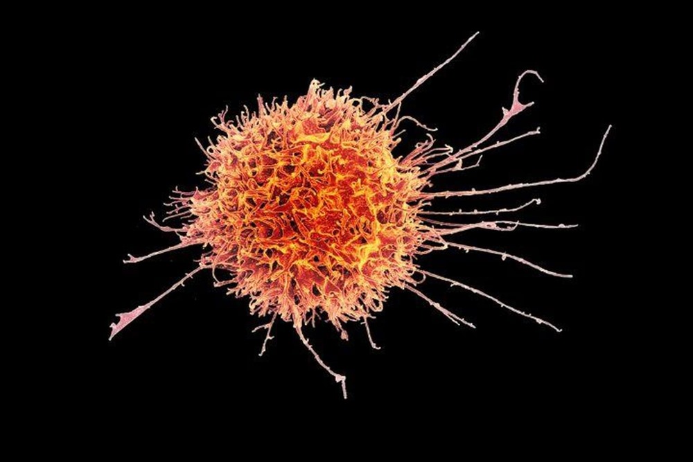 Pour échapper à la chimiothérapie, les cellules cancéreuses se mettent dans un état similaire à l’hibernation