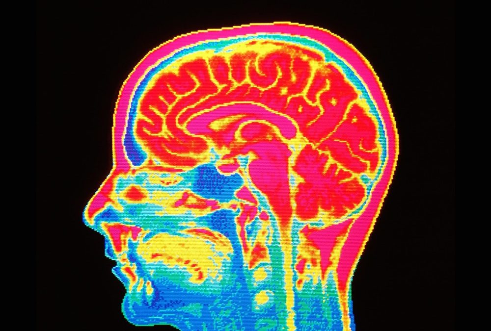 Certaines de nos cellules cérébrales seraient plus actives plusieurs heures après notre mort