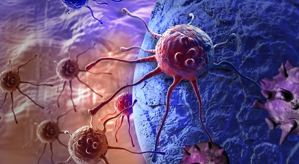 Premier essai clinique d’un virus expérimental capable d’éliminer un cancer