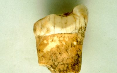 L’émail des dents des Néandertaliens indique qu’ils étaient peut-être carnivores