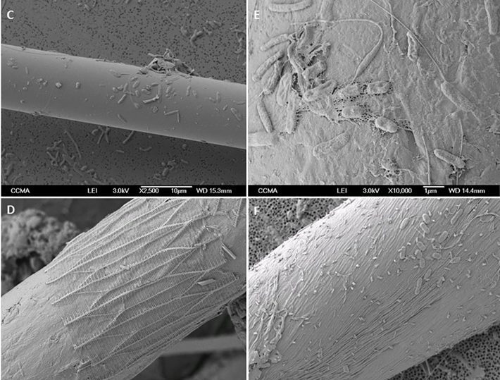 Des bactéries se logent dans les microfibres de plastique qui polluent les mers