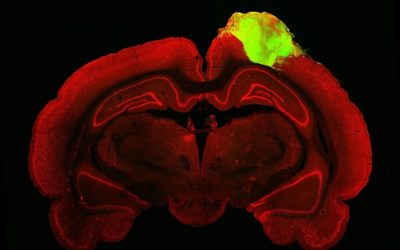 Des organoïdes de cerveau humain greffés sur des rats réagissent à la lumière et aux formes