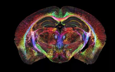 Des scanners du cerveau devenues 64 millions de fois plus précis