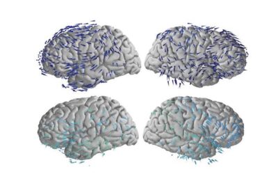 Comme des vagues neuro-électriques : des scanners montrent comment le cerveau mémorise et se souvient
