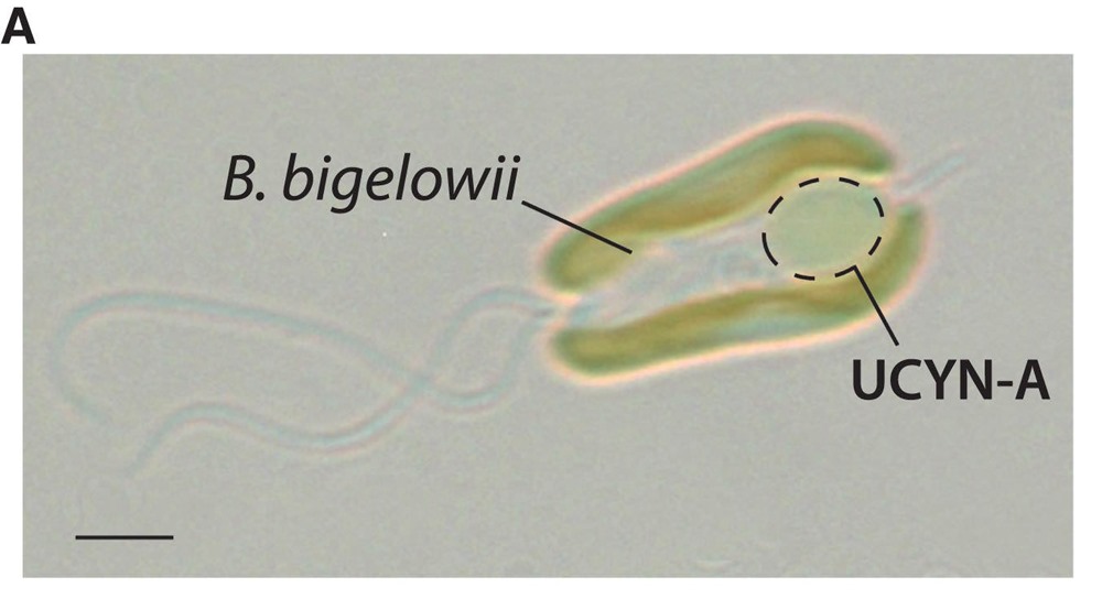 UCYN-A - algue Braarudosphaera bigelowii 1 24